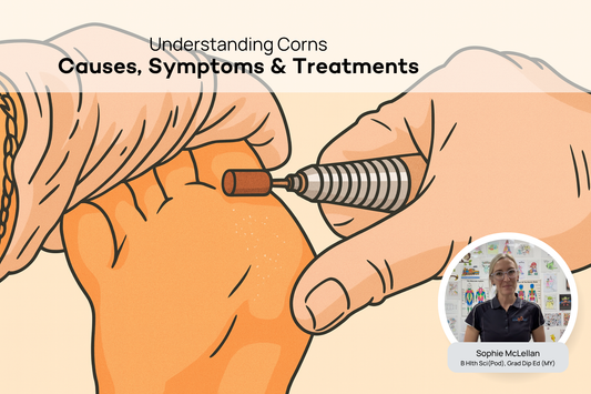 What Are Corns? A Podiatrist Explains the Causes and Treatment