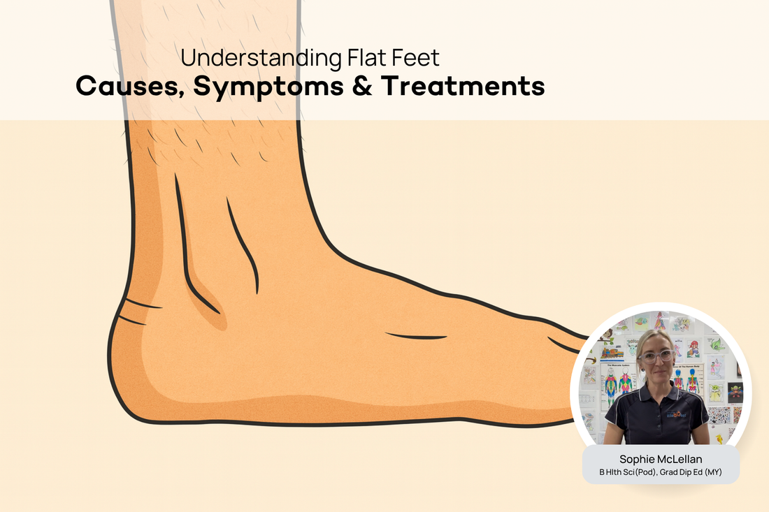 What are Flat Feet? A Podiatrist Explains the Causes and Treatment